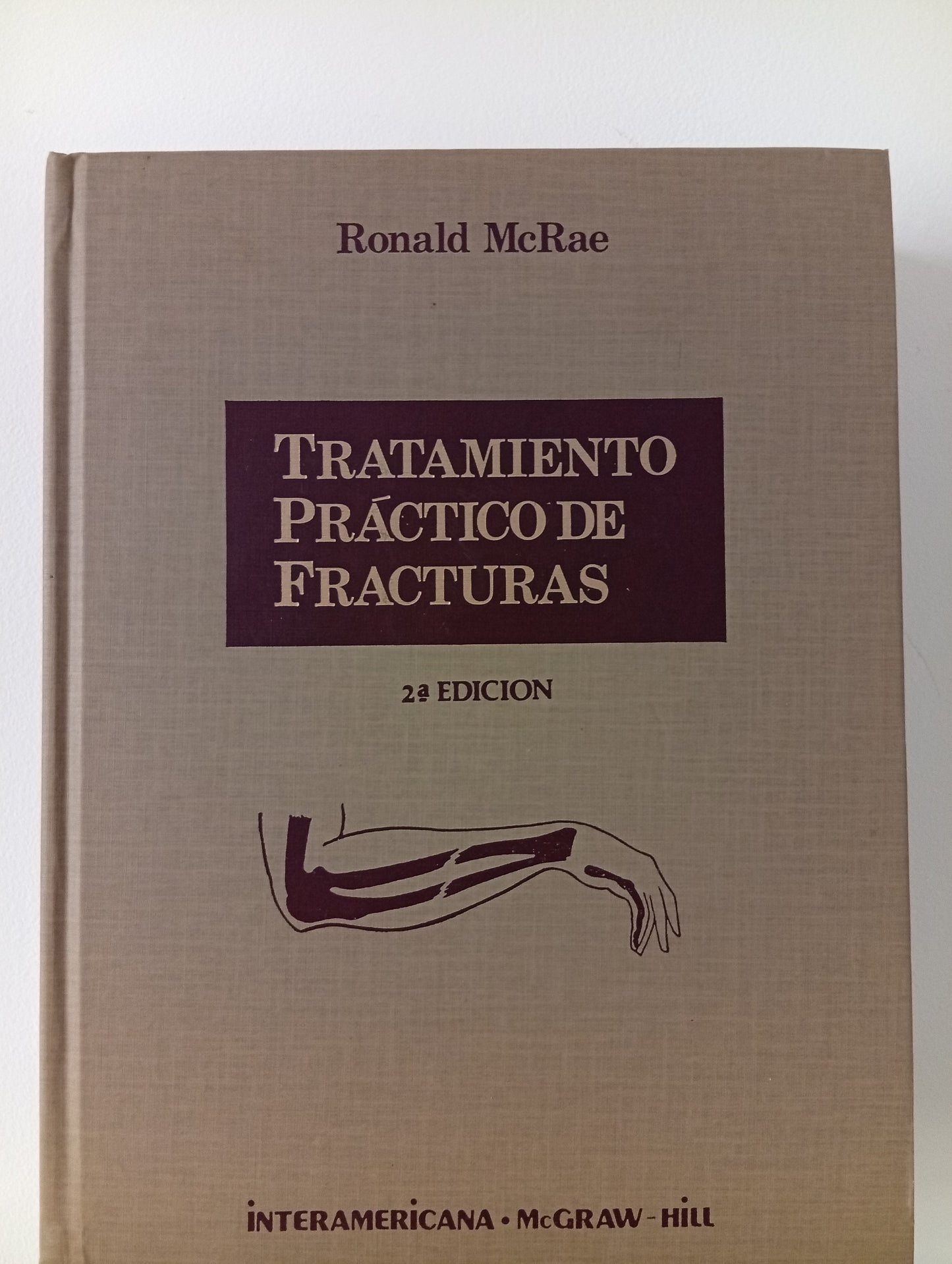 Tratamiento práctico de fracturas