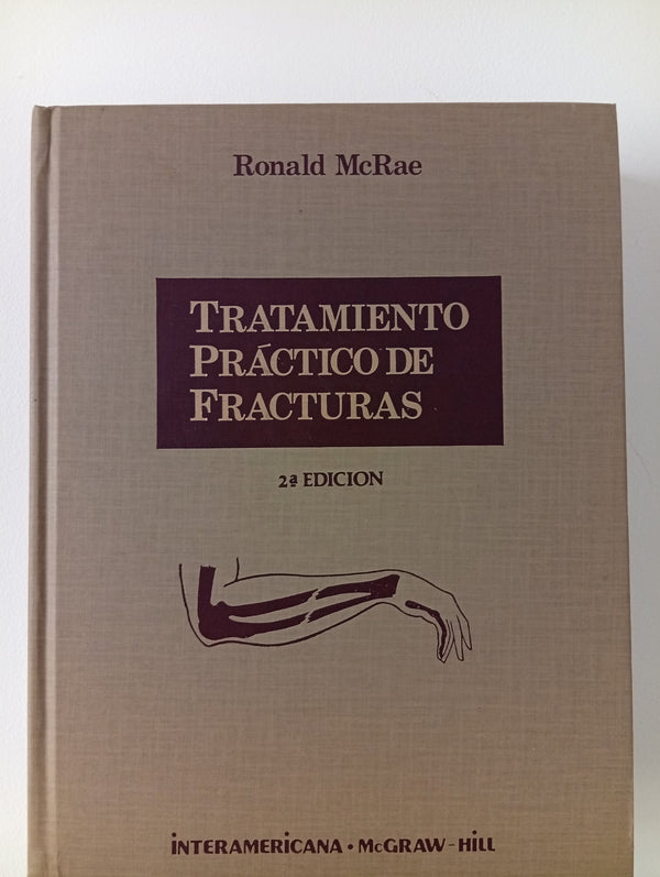Tratamiento práctico de fracturas